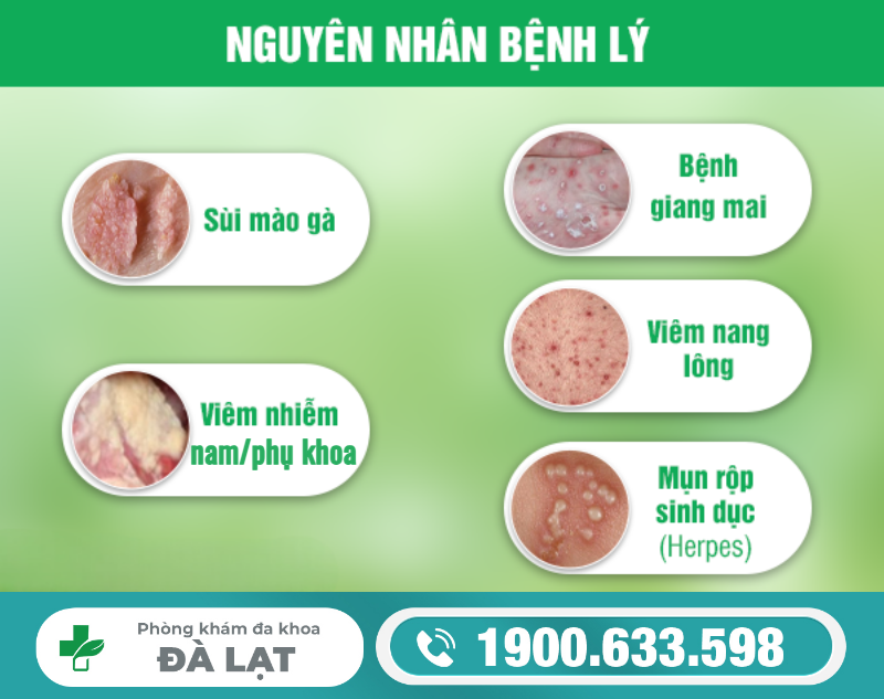 Hình ảnh minh họa